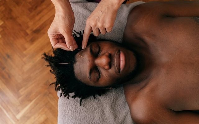 L'acupuncture