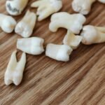 Gros plan détaillé de plusieurs dents humaines extraites disposées sur une surface de fond en bois.
