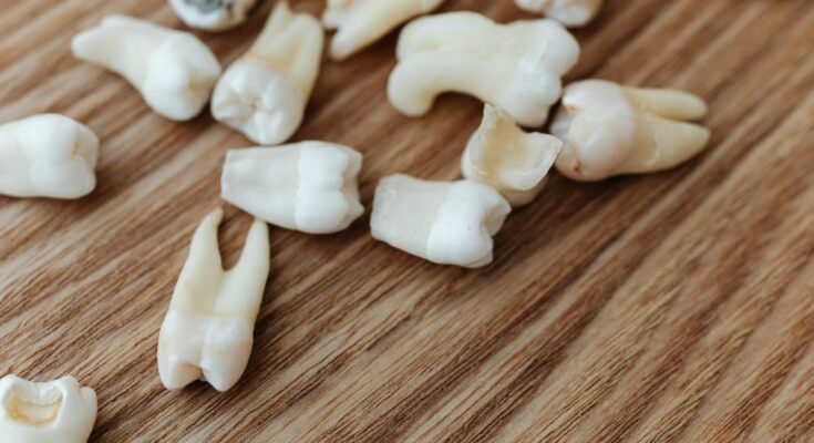 Gros plan détaillé de plusieurs dents humaines extraites disposées sur une surface de fond en bois.